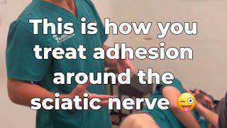 #chiropractor PTs & MTs - This is How to Treat Adhesion Around the Sciatic Nerve