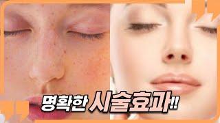 피부과 시술 을 가장 극대화 할 수 있는 방법 ┃ 레이저 리프팅 보톡스 필러 스킨부스터 ┃ 당신이 받은 피부과 시술이, 효과가 없었던 이유는 ?