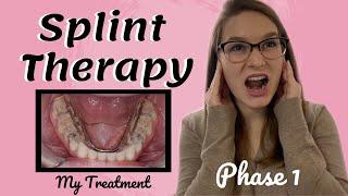 TMJ Splint Therapy | Phase I | My Treatment