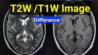 T2W AND T1W IMAGE DIFFERENCE #MRI BRAIN T1W and T2W DIFFERENCE #T2Wand T1w