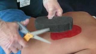 Wound Vac Demonstration