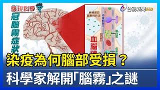 染疫為何腦部受損？ 科學家解開「腦霧」之謎【發現科學】