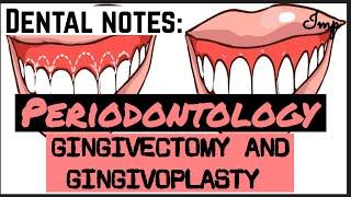 GINGIVECTOMY AND GINGIVOPLASTY II PERIODONTOLOGY