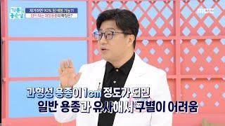 [기분 좋은 날] 암이 되는 대장용종의 특징?!, MBC 240614 방송