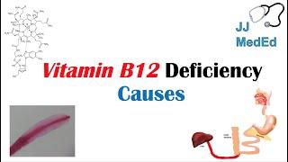 Causes of Vitamin B12 Deficiency | In-Depth Overview including Medications, Diseases & Fish Tapeworm