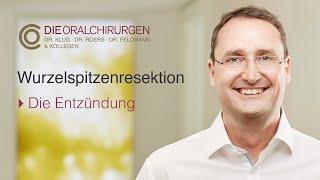 Wurzelspitzenresektion - Wie kommt es zu der Entzündung? (Dr. Daniel Klug)