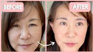 Anti-Aging Face Exercises to Widen and Lift Eyes. For Eye Bags+Dark Circles+Under Eyes+Wrinkles