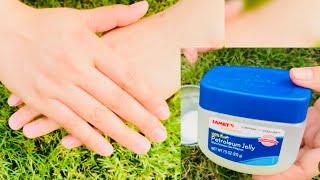 Hand whitening | Winter skin care | ⁠Vaseline uses | Milk benefits for skin | Hand care tips