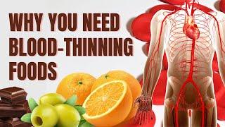 Heart Health: Natural Blood Thinners That May Prevent Stroke