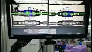 Disposable blood lancet fully automatic equipment line with inspection