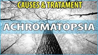 What is  Achromatopsia, Causes, Symptoms and Treatments