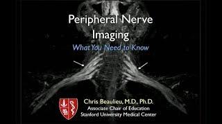 Peripheral Nerve Imaging: What You Need to Know