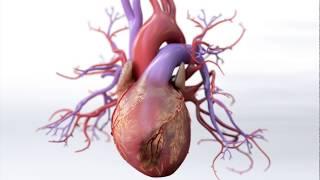 What is Coronary Artery Disease - Mechanism of Disease