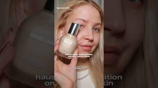 This is what the Haus Labs foundation looks like with NO FILTER on acne skin!