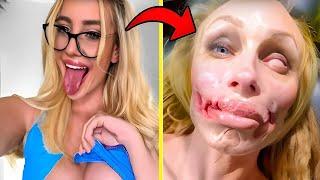 25 Celebrity Plastic Surgery Disasters