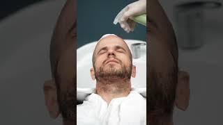 First Hair Wash After Hair Transplantation ~ Long Hair Center.