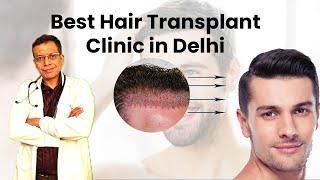 Best Hair Transplant Surgeon Clinic in Delhi at Care Well Medical Centre