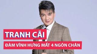 Đàm Vĩnh Hưng công bố mất 4 ngón chân gây tranh cãi