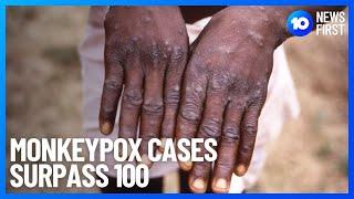 Monkeypox Cases Double In U.K. And Surpass 100 Globally | 10 News First