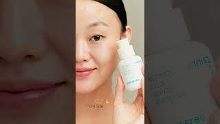 INNISFREE Retinol Cica Repair Ampoule - Struggling with Clogged Pores?