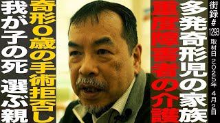 小児外科医 松永正訓/多発奇形児の家族/重度障害者の介護/奇形0歳の手術拒否し我が子の死選ぶ親