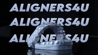 Aligners4U: The Comprehensive Guide to the Aligner Process #alignerorthodontics #dental#orthodontist