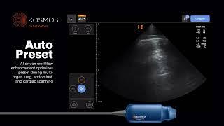 Kosmos on iOS Full POCUS Capabilities