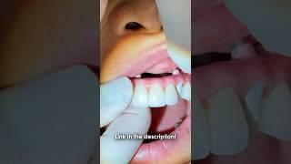 From L.A. to New York to Chicago #dental #smile #teeth #shorts #shortvideo #video #dentist #implants