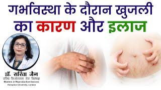 Cholestasis of Pregnancy || Dr Sarita Jain ||