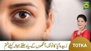 Zubaida Apa Totkay | Ankhon Ke Halke Khatam Karne Ka Tarika | Dark Circles Ka Ilaj | Masala TV