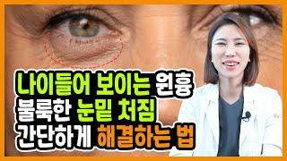 눈 밑 처짐. 눈 밑이 진짜 불룩해지는 이유. 돈 한푼 안들이고 집에서 좋아지는 방법