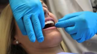 Instructions for Using a Teeth Whitening Strip : Dental Health