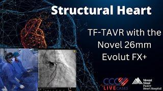 First Live Case in the World of﻿ TF-TAVR with the Novel 26mm Evolut FX+