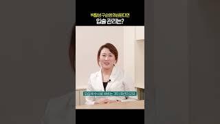 박탈성 구순염 의심된다면 입술 관리는?