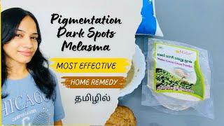 தமிழில் - Most Effective Home Remedy for Pigmentation, Dark Spots & Melasma ️in Tamil