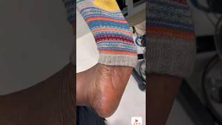 N Nurse Ebony Sock Removal & Big Dry Sole At Work [SHORTS]