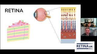 “Mini-Retina” – A tool to unlock the future of restored vision in retinal blindness