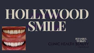 Hollywood Smile Istanbul, Turkey @ClinicHealthBeauty