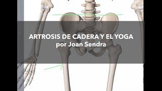 Artrosis de Cadera y el Yoga