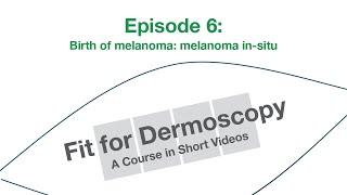 Fit for Dermoscopy Episode 6 – Birth of melanoma: melanoma in situ