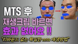 리바운드현상 없는 가장 효과나는 mts재생방법