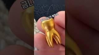 금니 하나로 벌어진 충격 실화