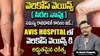 How to Get Rid Varicose Veins | Best Varicose Veins Treatment | Dr Rajah V Koppala | AVIS Hospital