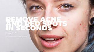 Remove acne and red spots with Photoshop and Magic Touch Panel in seconds