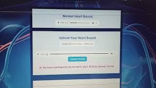 Heart Consultation Made Easy #intellibus