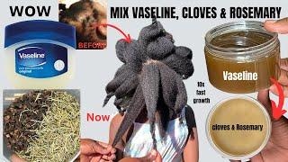 WOW  Mix VASELINE with CLOVES & ROSEMARY &  Grow Hair Like Never Before 10x FASTER.