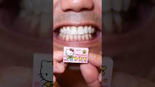 ASMR | Do you love Hello Kitty? Do you love bubble gum? #Doctor Tristan Peh #HelloKitty #BubbleGum