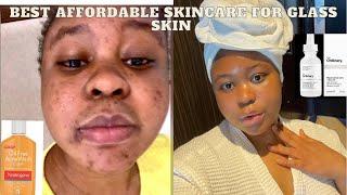 How I cleared my skin|Best skincare routine for acne & scars|Go to bed with me routine#acne#skincare