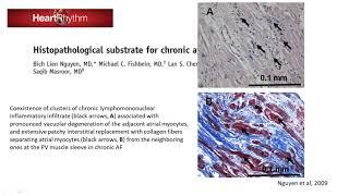 Pathophysiology, risk factors and prevention of atrial fibrillation   Dr  Omar Riad, MSc, MRCPUK