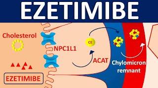 Ezetimibe - Mechanism, side effects, precautions & uses